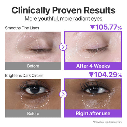Numbuzin No.9 NAD+ Retinol Eye Cream, Depuffing & Firming Eye Serum for Dark Circles, Wrinkles & Fine Lines, Peptides & Niacinamide for Glow & Undereye Radiance